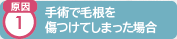 原因1 手術で毛根を切り取った場合