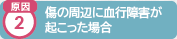 原因2 皮膚を引っぱり過ぎて抜け毛が起きた場合
