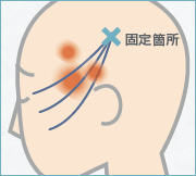 固定箇所