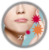 術後の痛み・違和感