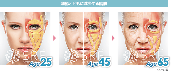 加齢とともに減少する脂肪