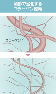 加齢で劣化するコラーゲン線維