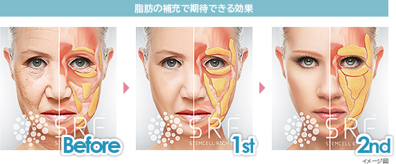 脂肪の補充で期待できる効果